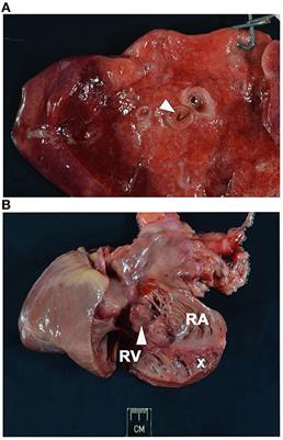 Case report: Disseminated intravascular coagulation in a dog following treatment with melarsomine for Dirofilaria immitis